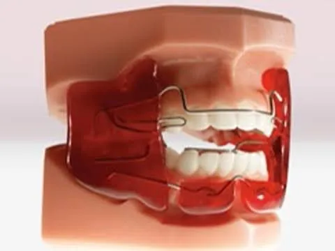 Clinician carrying out myofunctional appliance at Aurum Dental Clinic