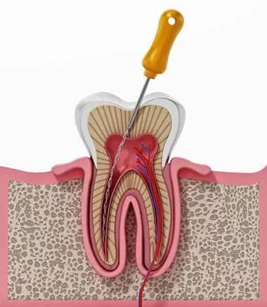 Clinician carrying out endodontics at Aurum Dental Clinic