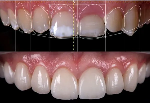 Clinician carrying out cosmetic procedures at Aurum Dental Clinic